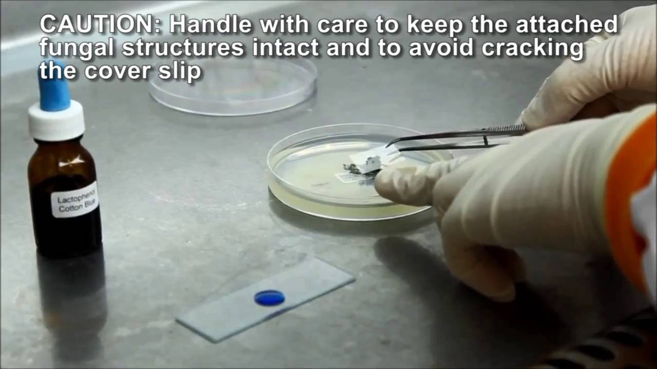 Slide Culture and Lactophenol Cotton Blue Staining