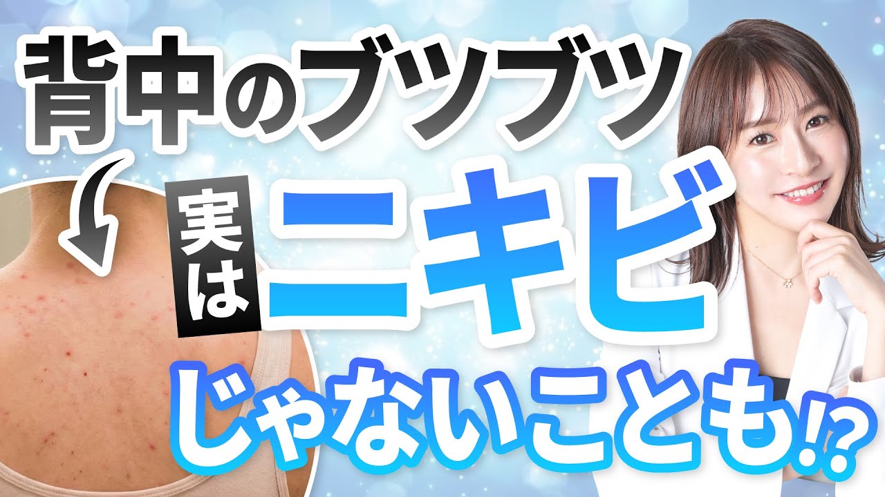 【治らない背中ニキビ】救世主はまさかの〇〇！？あなたの背中ニキビの原因はコレです！【マラセチア毛包炎/皮脂分泌】