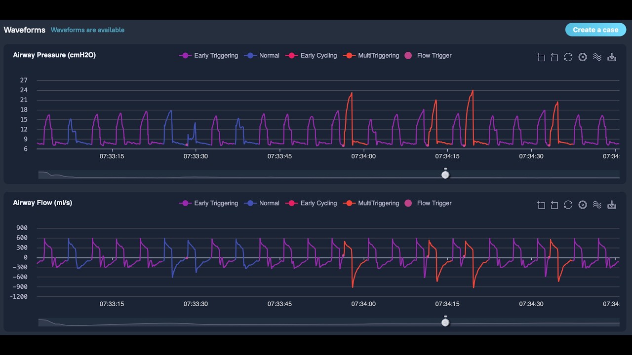 Deep Breath Research Functionality Demo