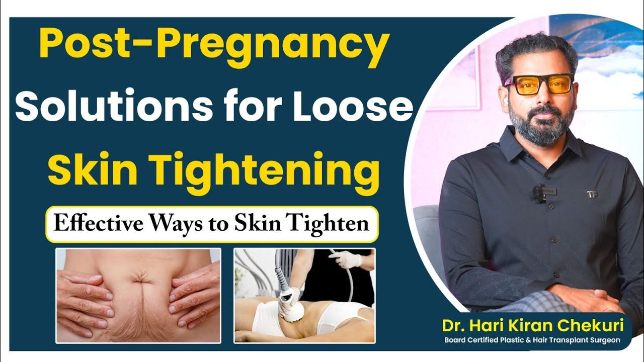 Post-Pregnancy Loose Skin Tightening Solutions | Safe & Effective Treatments Explained