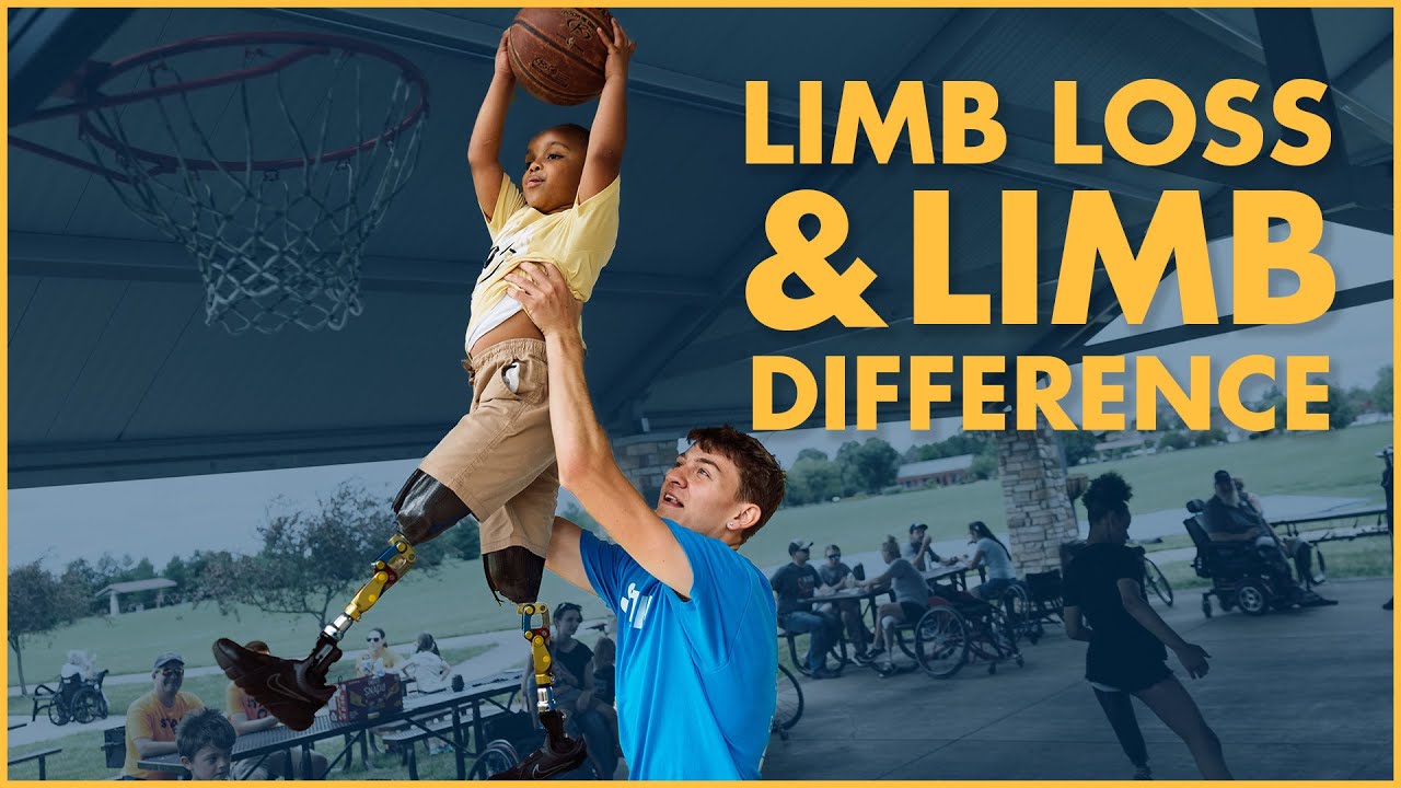 Limb Loss and Limb Difference Day