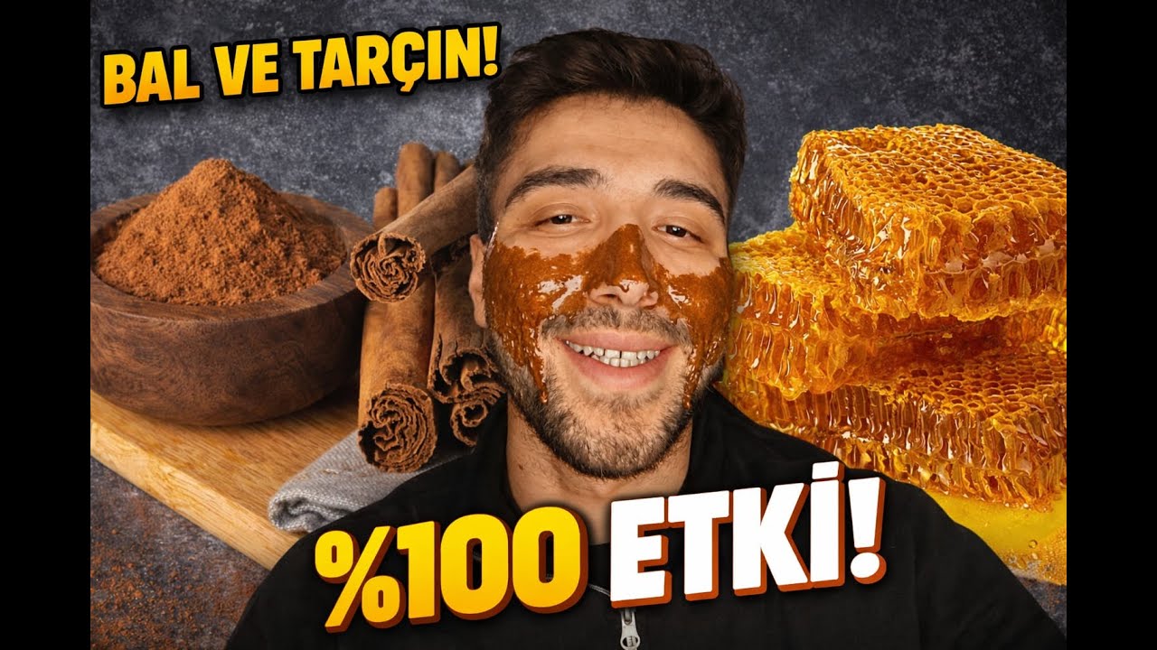 SİVİLCELERE ELVEDA ETTİM