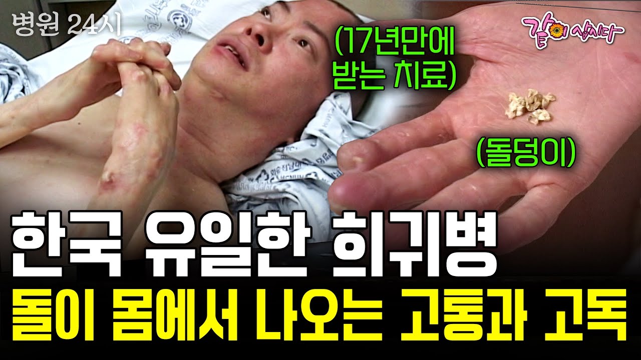 열세살 부터 몸이 굳어, 남은 것은 희귀병 뿐.돌이 몸에서 나오는 고통에 포기했던 그에게 찾아온 한줄기 희망. [병원24시] | KBS 2004.08.05
