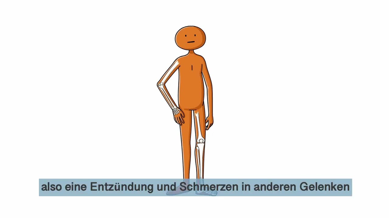 Könnte es Morbus Bechterew – axSpA sein?