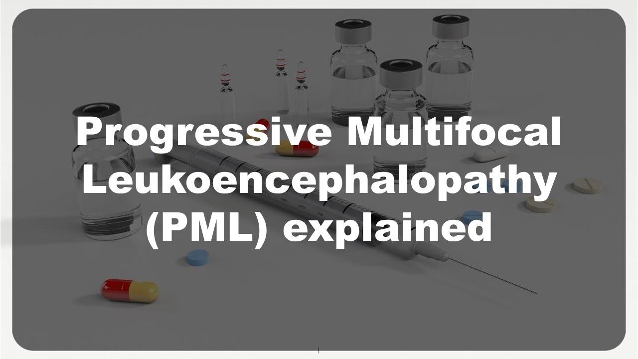 PML explained #26