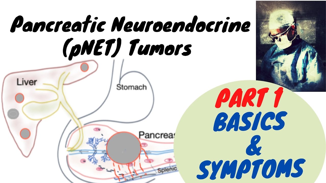 Pancreatic Neuroendocrine Tumor Part 1; Basics and Symptoms