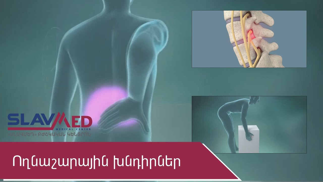 Ողնաշարային խնդիրներ