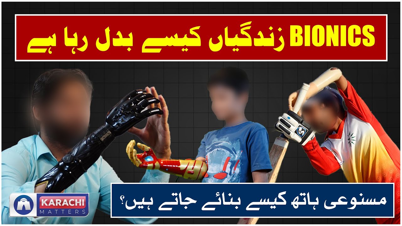 Bionics | A hope for every Disable Person | #technology #robot