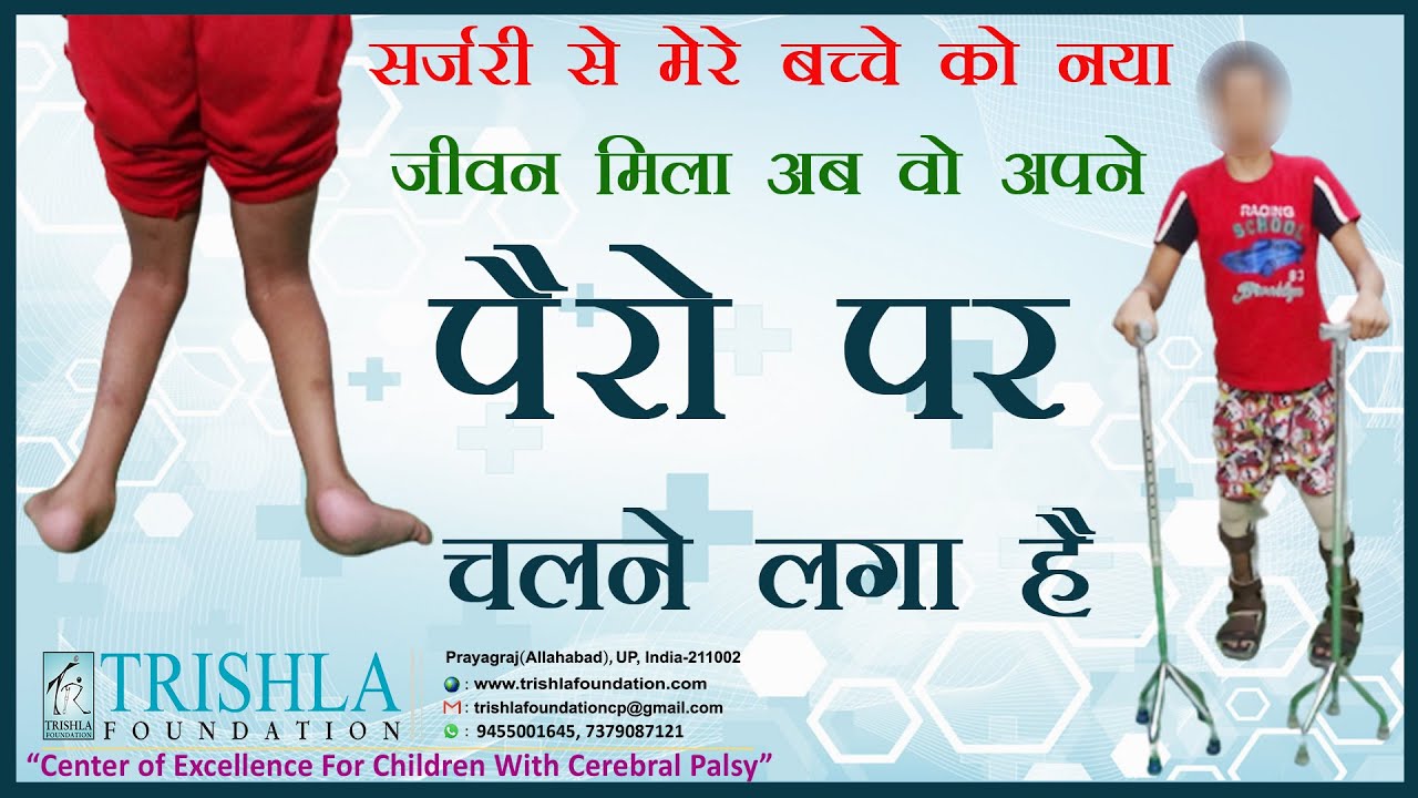 Cerebral Palsy: Long Term Follow Up with Good Recovery of CP Child | Trishla Foundation