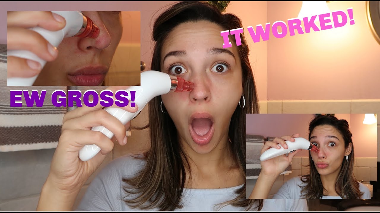 Electric Blackhead Remover | Does it work? | UP CLOSE FOOTAGE