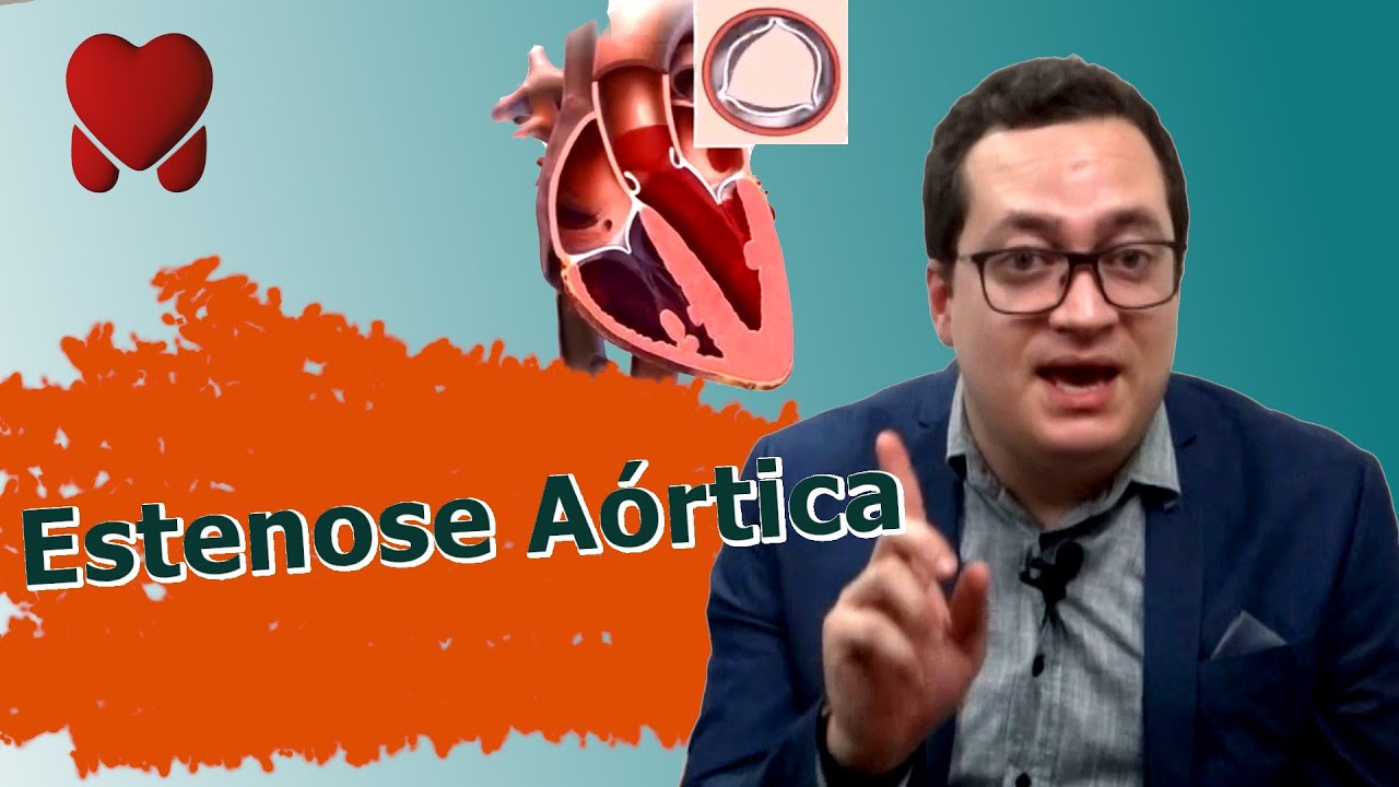 Estenose Aórtica
