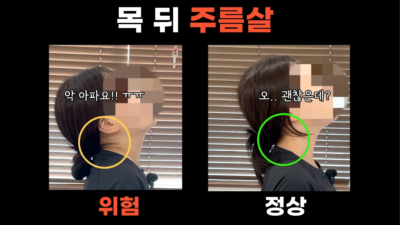 거북목? 일자목? 버섯목? 목 통증 원인과 주름살을 조심해야 하는 이유