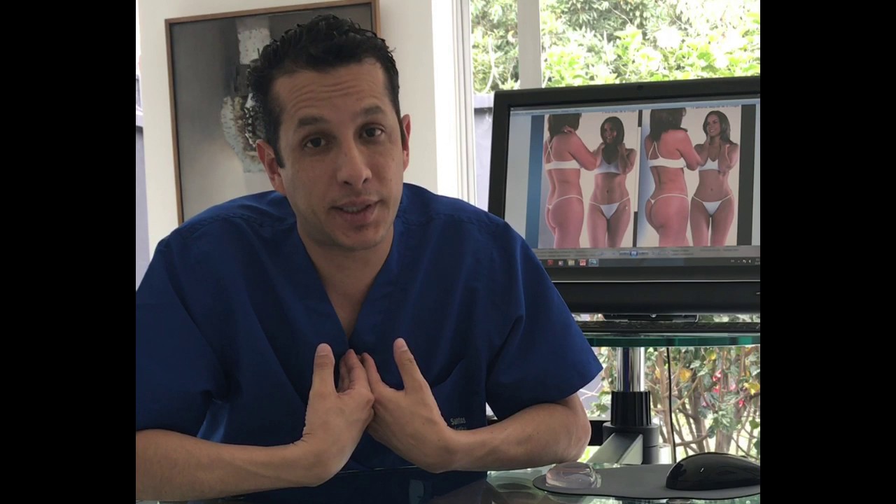 Abdominoplastia | Dr. Ivan Santos - Cirugía plástica en Colombia |