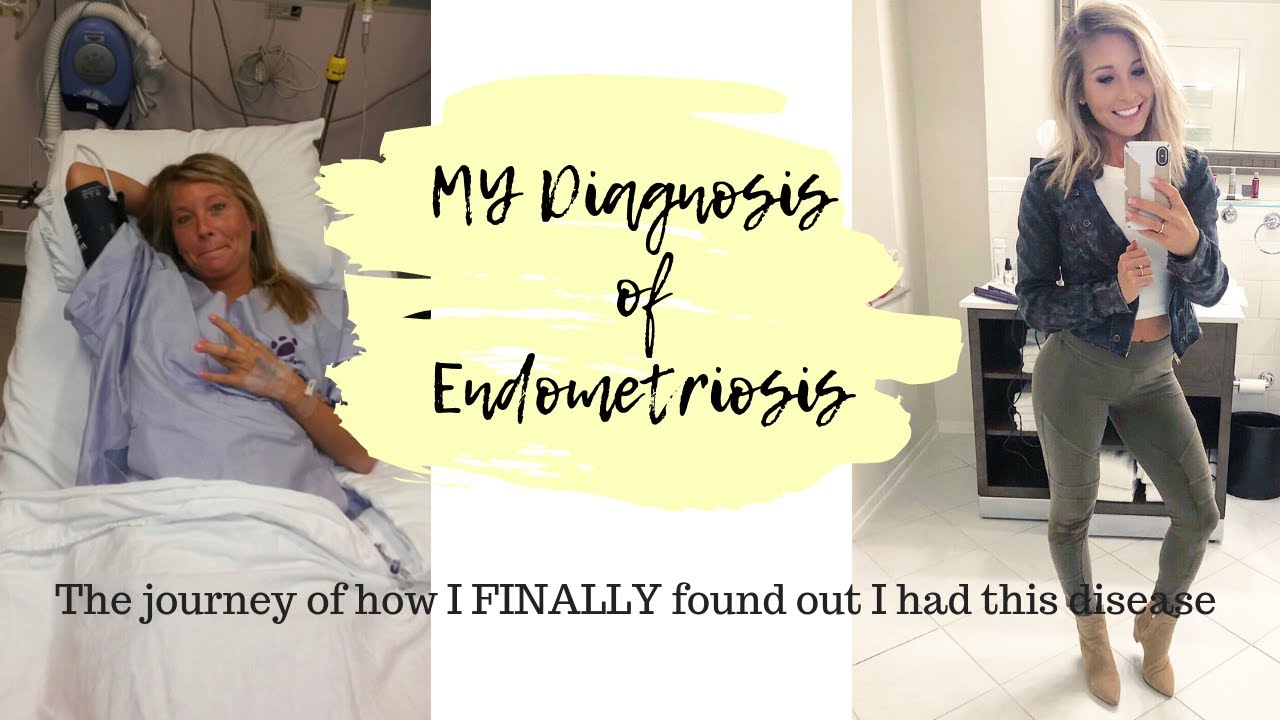 MY Diagnosis of Endometriosis