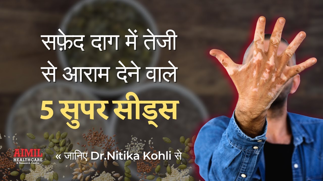 5 Super Seeds for Faster Vitiligo Recovery | Dr. Nitika Kohli Reveals!