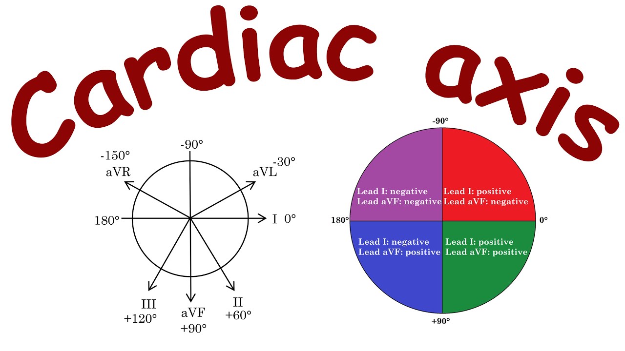 ECG basics: cardiac axis