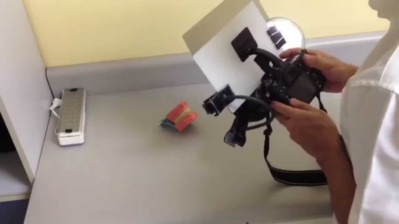 Fotos intrabucais sem reflexos com a polariza&ccedil;&atilde;o do flash embutido de c&acirc;mera DSLR Nikon