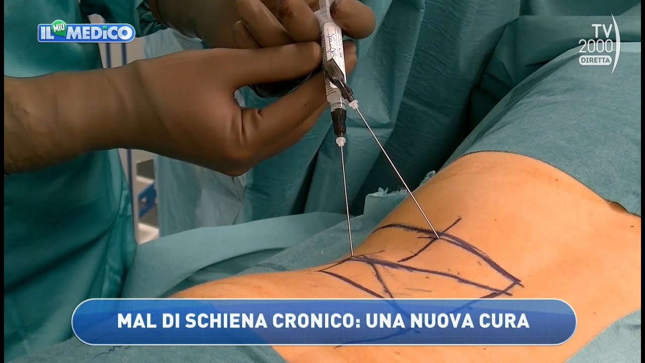 Il Mio Medico (Tv2000) - La chirurgia robotica per curare le patologie della colonna vertebrale