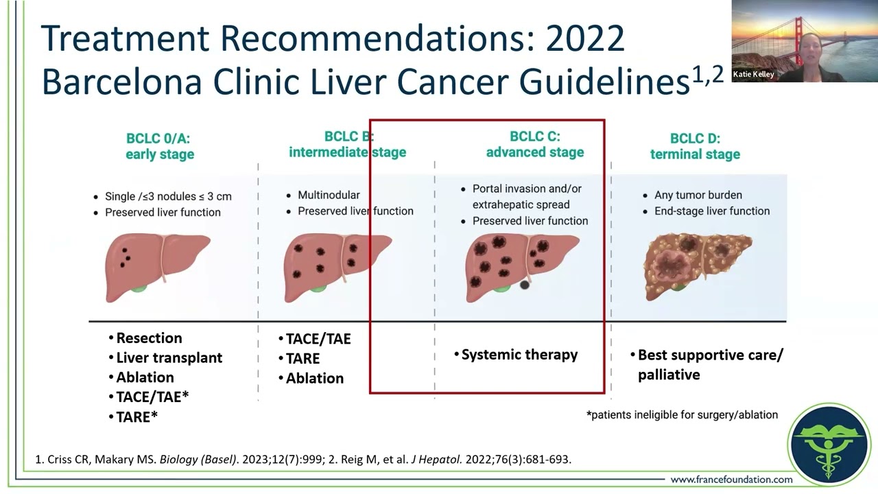 Translating Data Into Practice: The Role of Immunotherapy in the Management of Advanced HCC