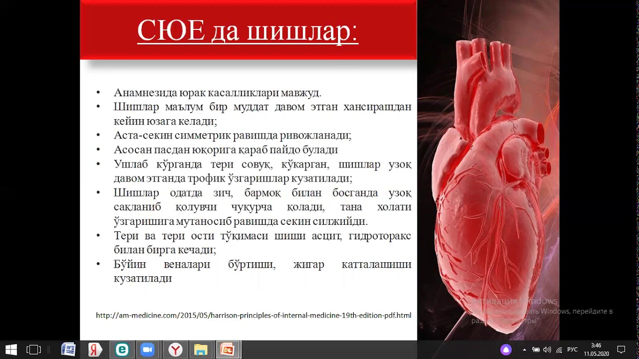 Шиш синдроми
