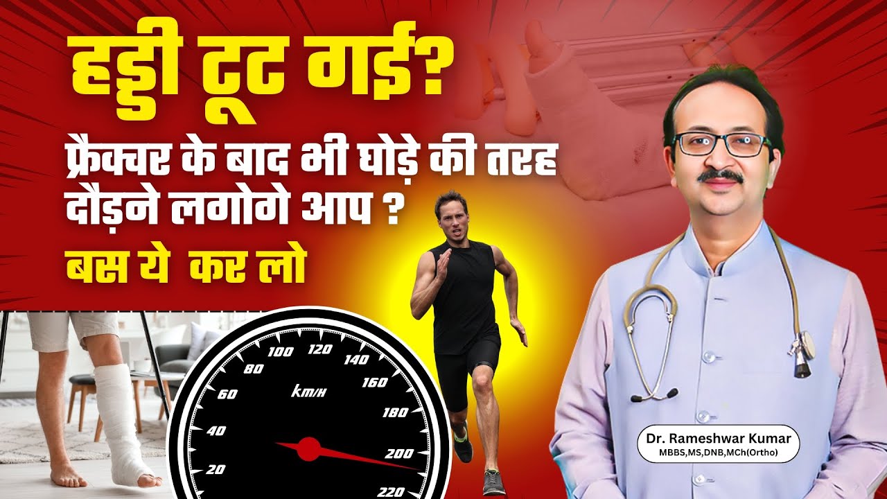 Fracture के बाद दौड़ना Possible है? जानिए Doctor की राय #drrameshwarkumar