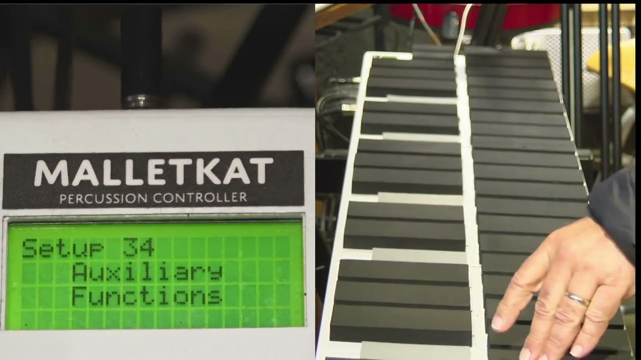 KIT AUXILIARY SCREENS