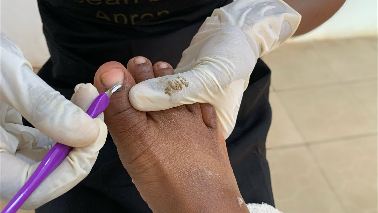 OMG 😱 SEE the amount of dirt 😩Pedicure Tutorial ❗️