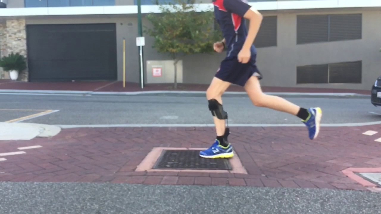 PDE Orthosis for Peroneal Nerve Palsy