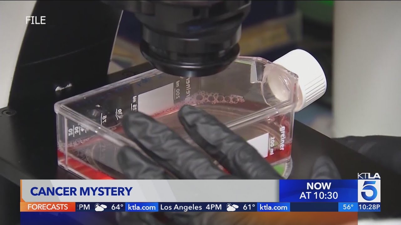 Cancer mystery in non-smoking women