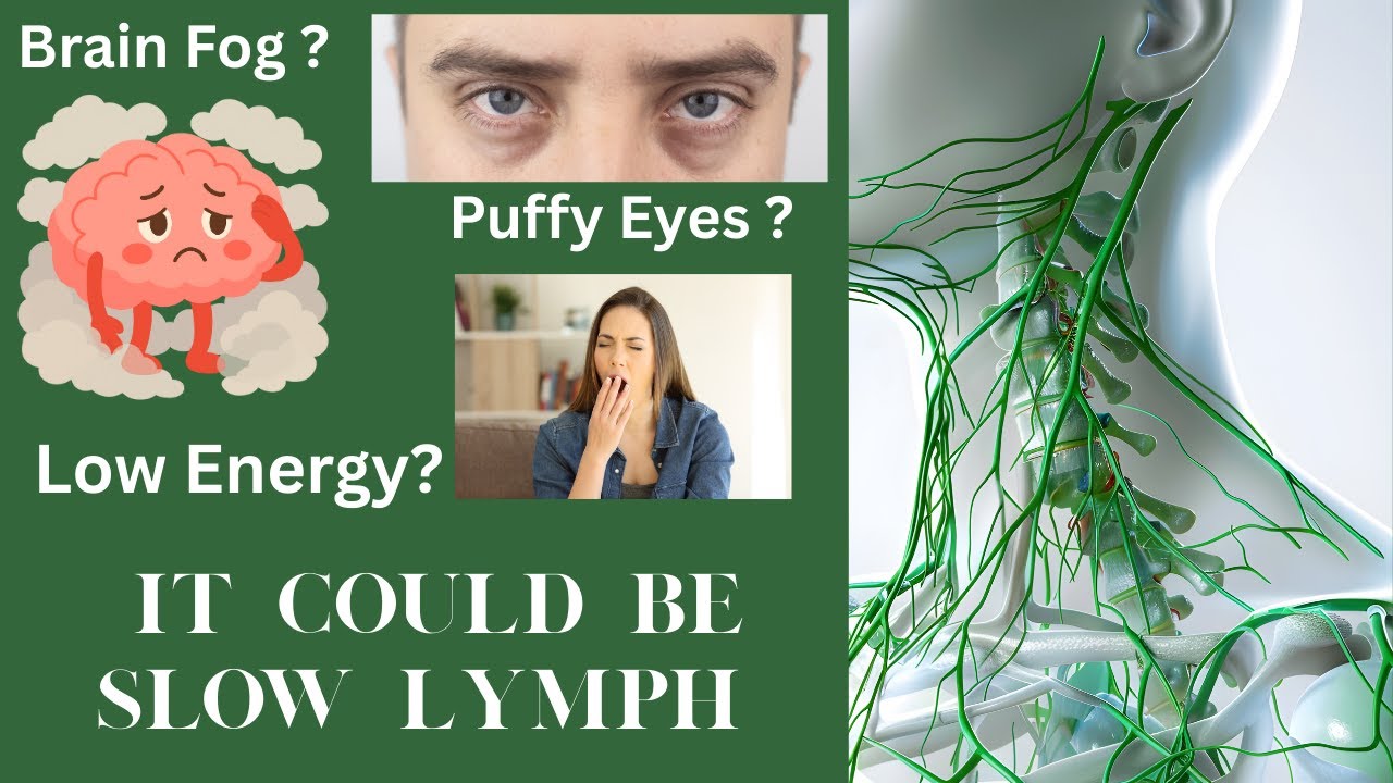 The Secrets of Lymph: Symptoms and Natural Relief of Brain Fog, Puffy Eyes, and Tiredness