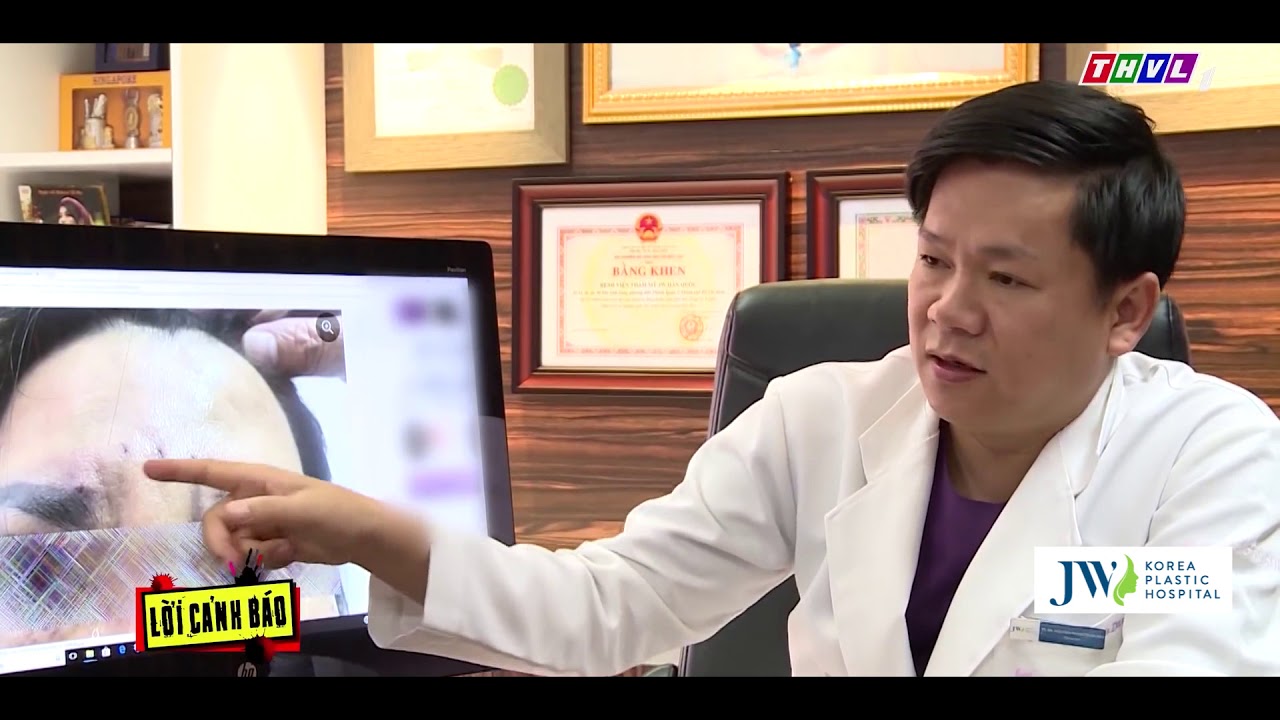 Lời Cảnh Báo: Treo Chân Mày Bằng Chỉ Ở Thẩm Mỹ Viện Không Uy Tín