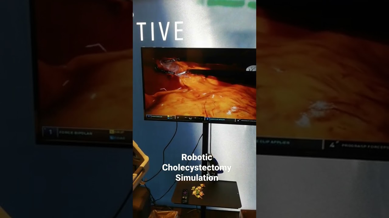 Robotic Gallbladder Removal Game (simulation robotic cholecystectomy)