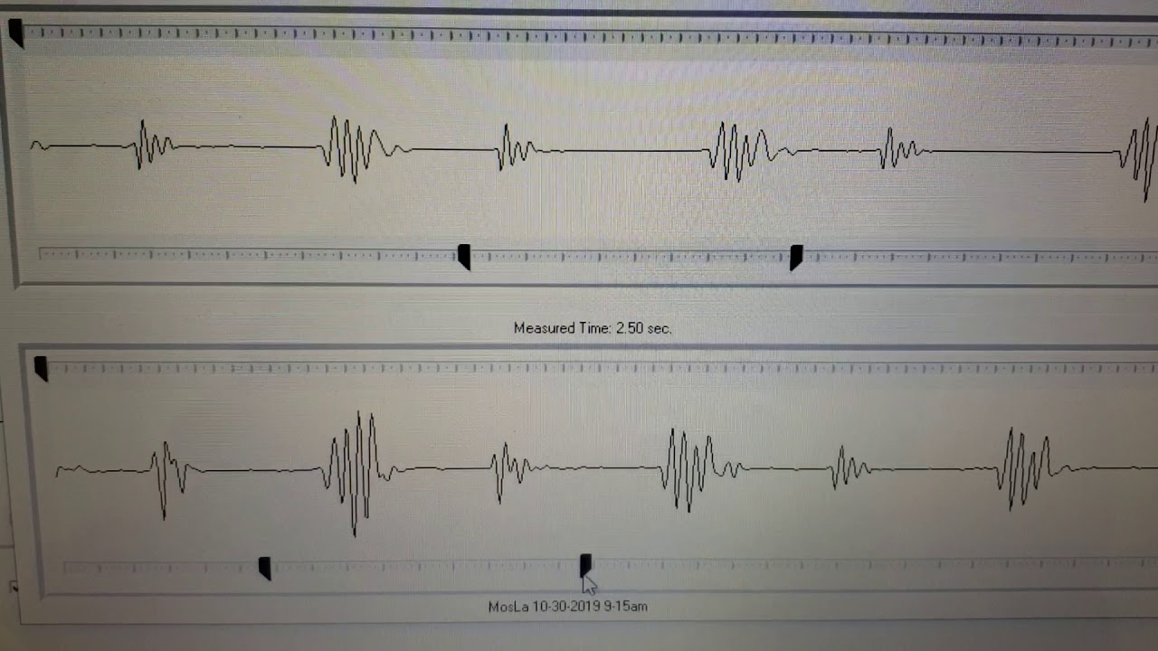 Another change on the Heart Sound Recorder.