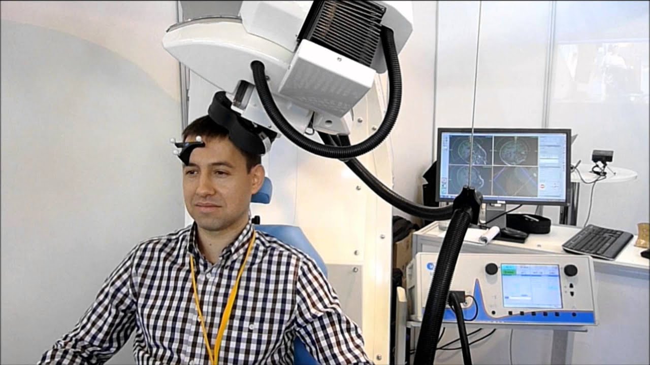 Simulation of MRI guided rTMS on the DLPFC using the Axilum Robotics' TMS-Robot