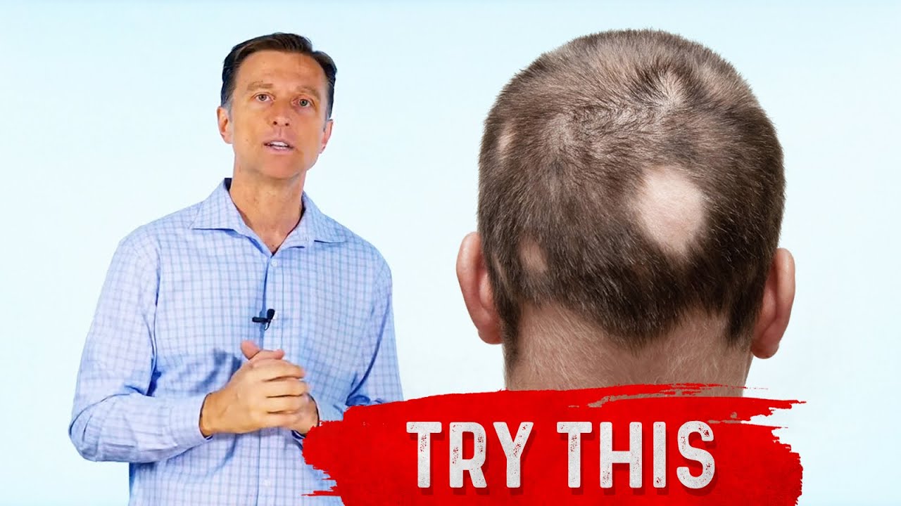 Onions, The Best Food for Alopecia Treatment &ndash; Dr.Berg
