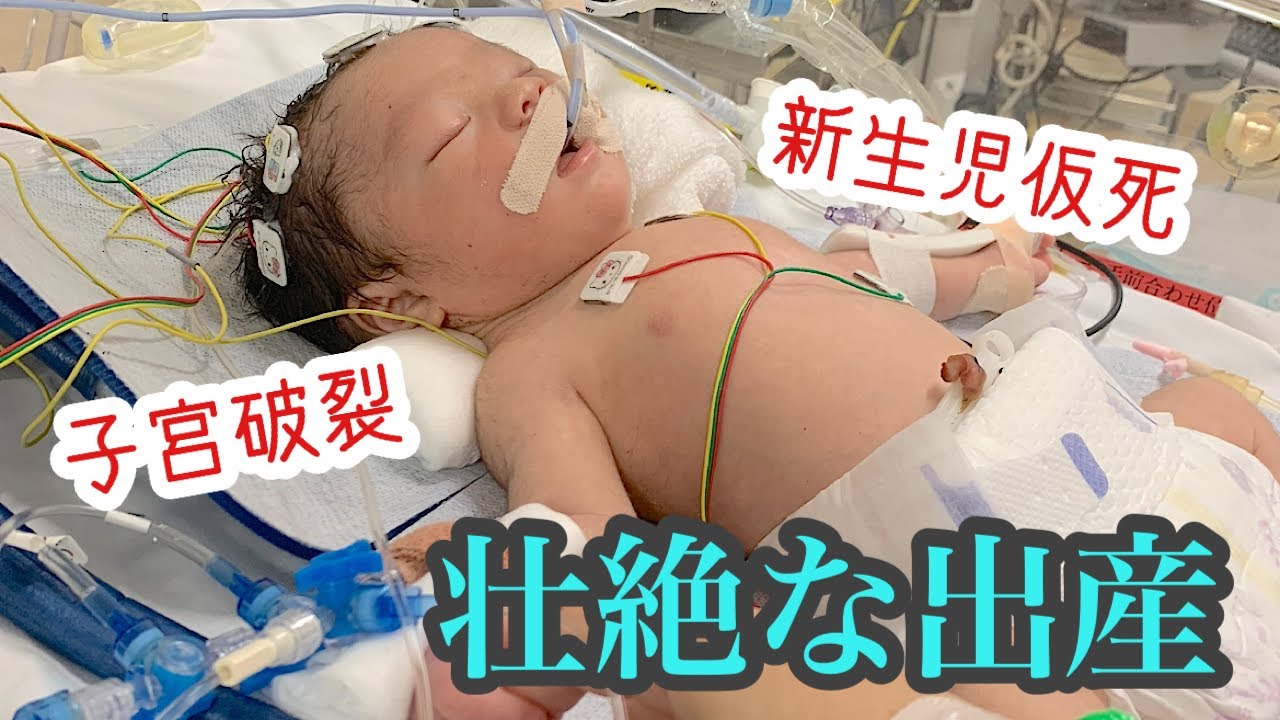 【出産レポ①】子宮破裂と新生児仮死。母子共に危険だった壮絶な出産エピソード