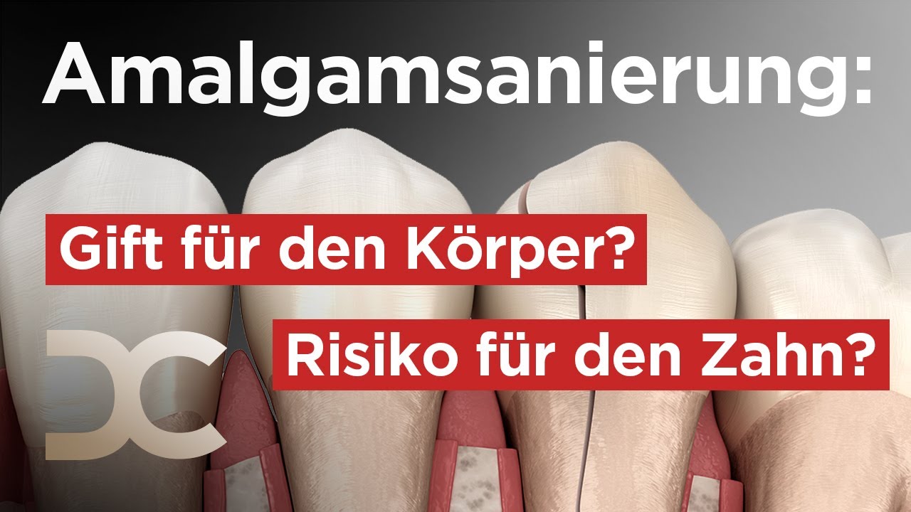 Amalgamfüllung austauschen oder nicht? Interview mit Dr. Kass | Dorow Clinic