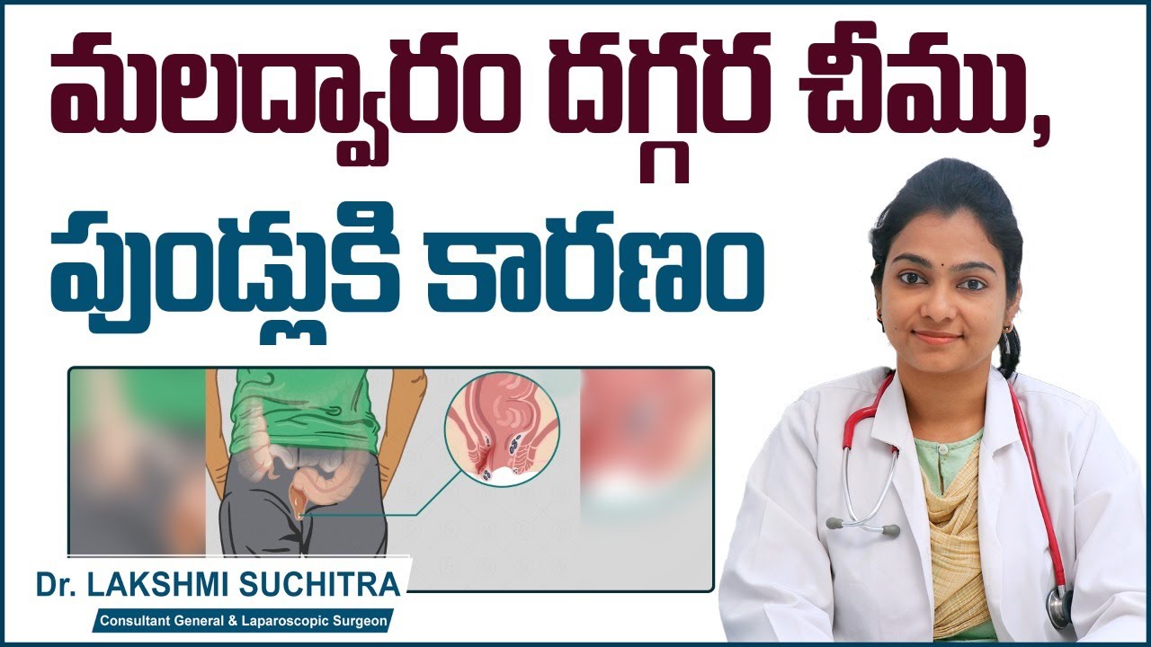 మలద్వారం దగ్గర చీము, పుండ్లు || Causes of Perianal Abscess and Fistula in Ano || Sankhya Hospitals
