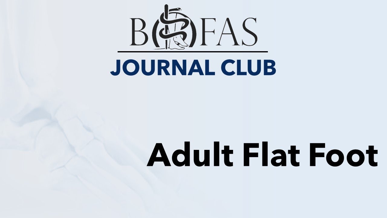 Adult Planovalgus Foot - BOFAS Journal Club