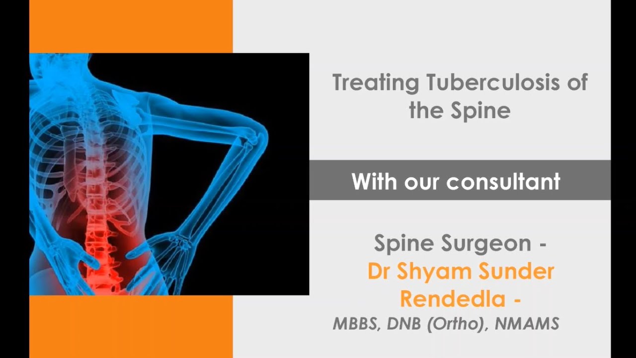 Treating Tuberculosis of the Spine