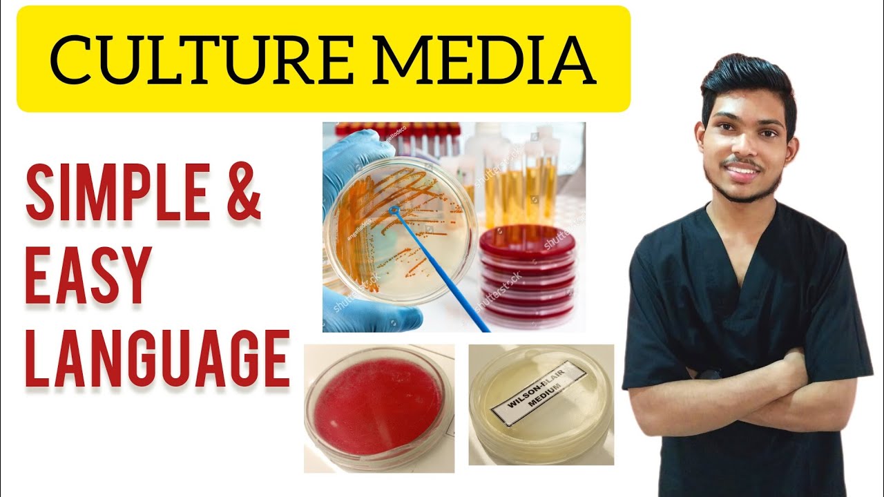 Culture media microbiology | Types , uses of culture media