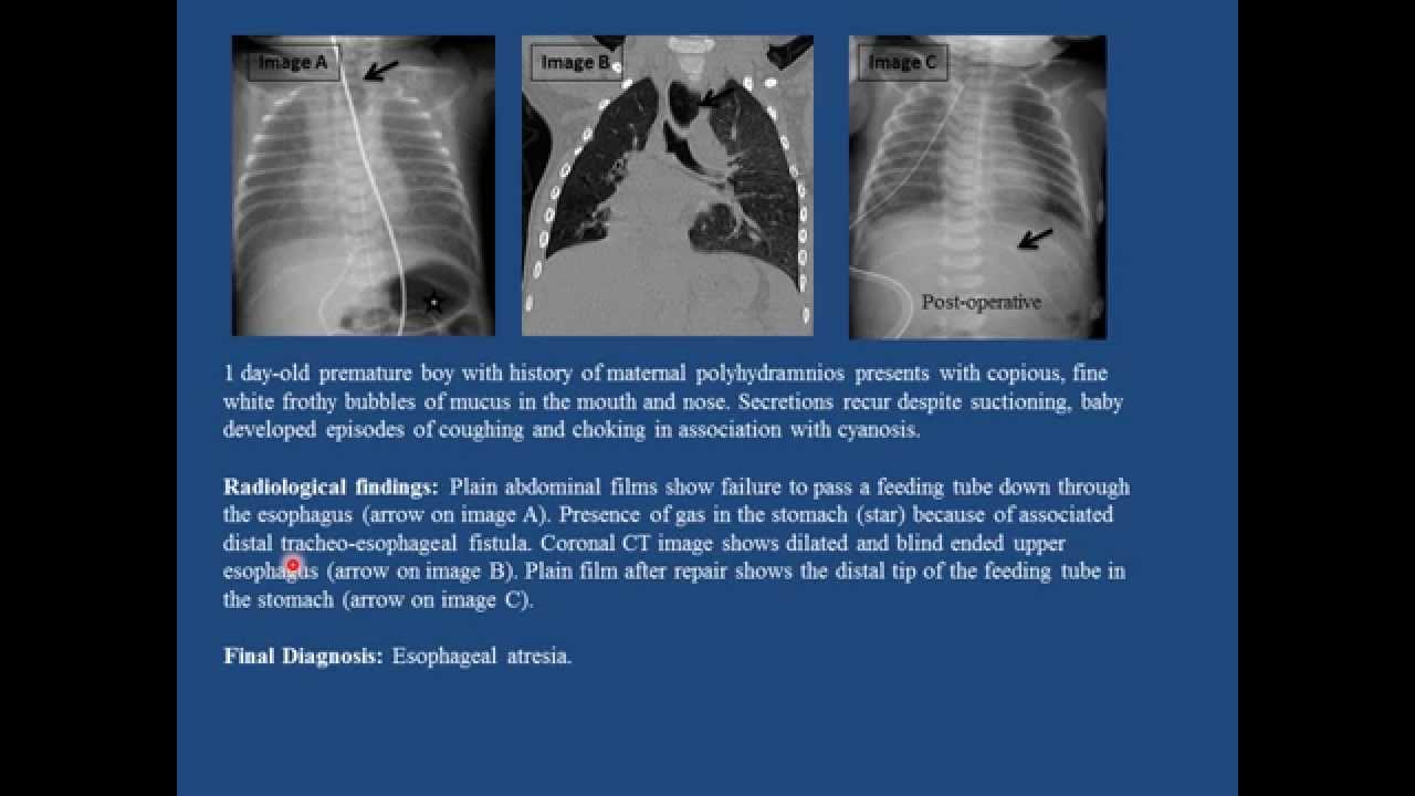 Pediatric Gastroenterology II