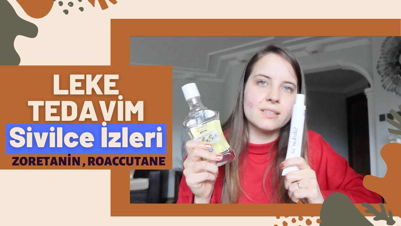 LEKE TEDAVİM | Sivilce İzlerim İçin Ne Kullanacağım ? |Zoretanin Sonrası