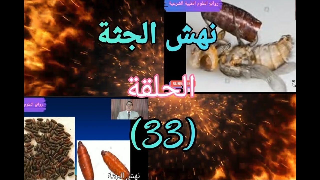 نهش الجثة ...الحلقة (33)