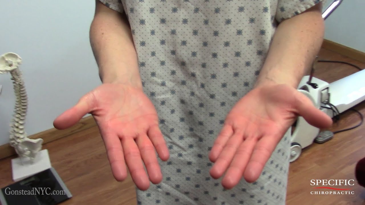 Raynaud's disease,  phenomenon HELPED Dr Suh Gonstead Chiropractor