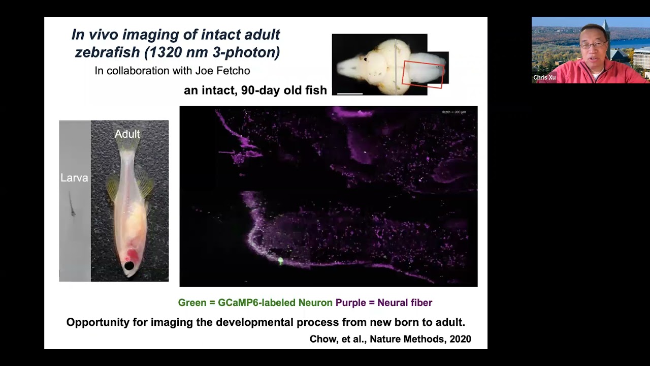 Deep Brain Imaging, Dr. Xu