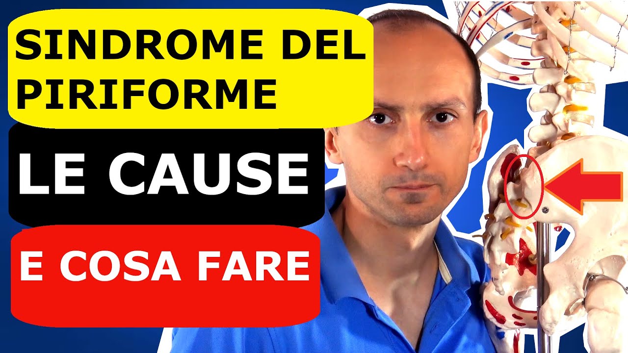 Sindrome del Piriforme, Perché ce l'hai, Cosa Fare e gli Esercizi più Utili.