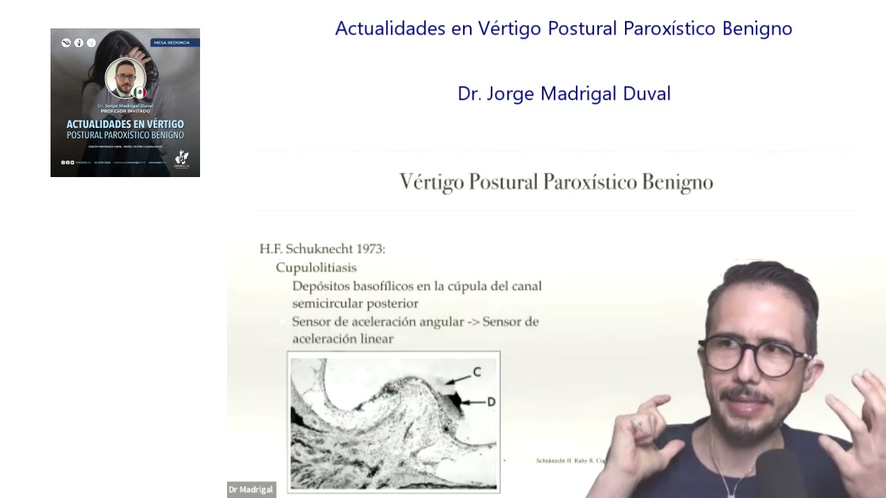 Actualidades en Vértigo Postural Paroxístico Benigno - Dr. Jorge Madrigal Duval