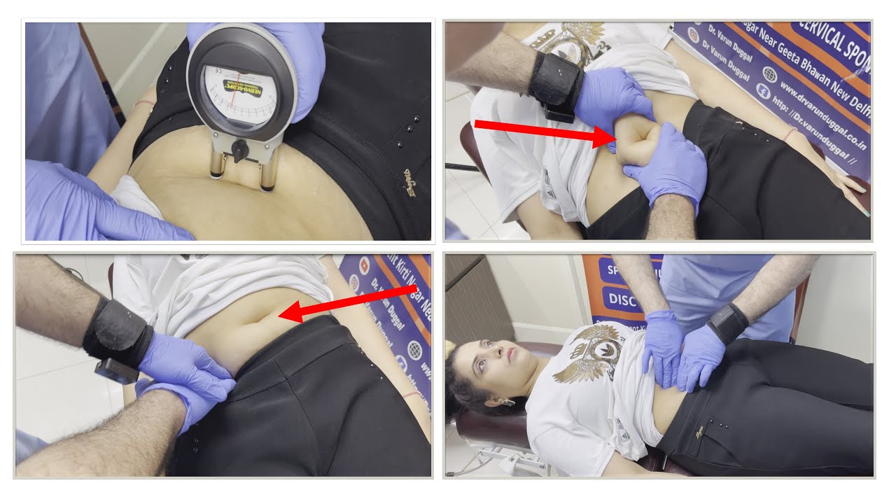 7 years old gas problem | navel displacement cured with chiropractic | chiropractic in Delhi