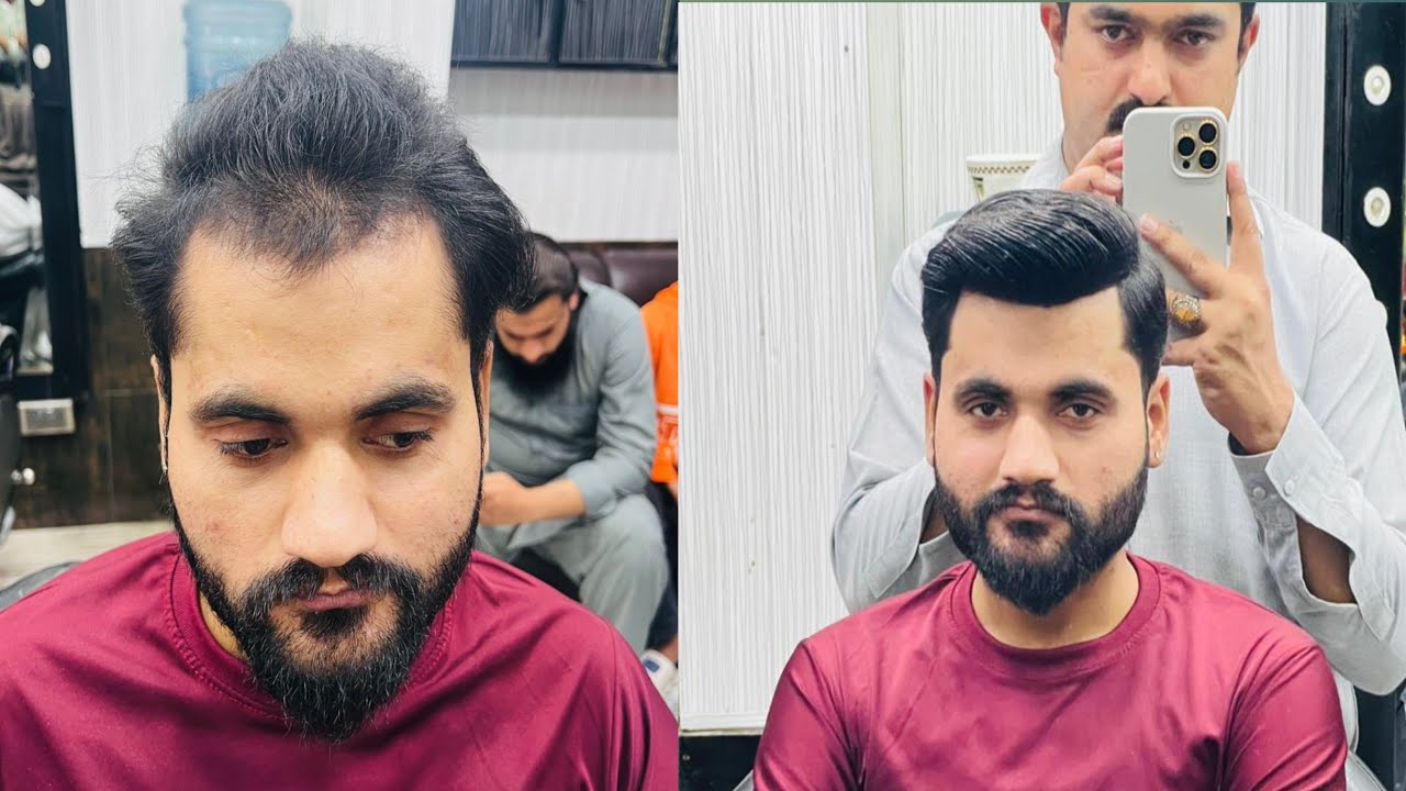 What are the latest Front hair line |  Available in Rawalpindi Pakistan | Falak Hair Club